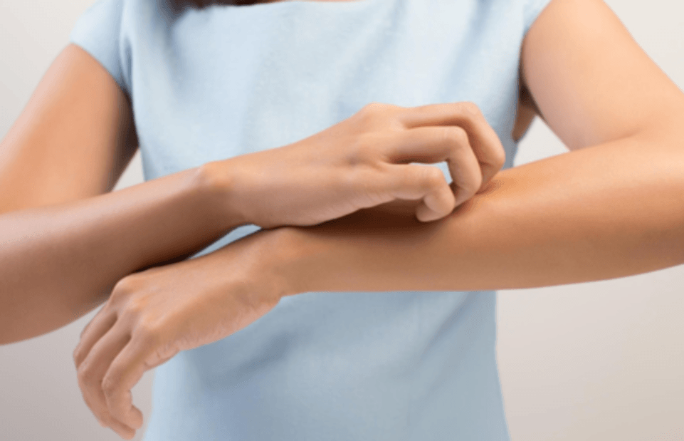 Laundry Detergent Allergy? Here’s Your Solution - Kind Laundry