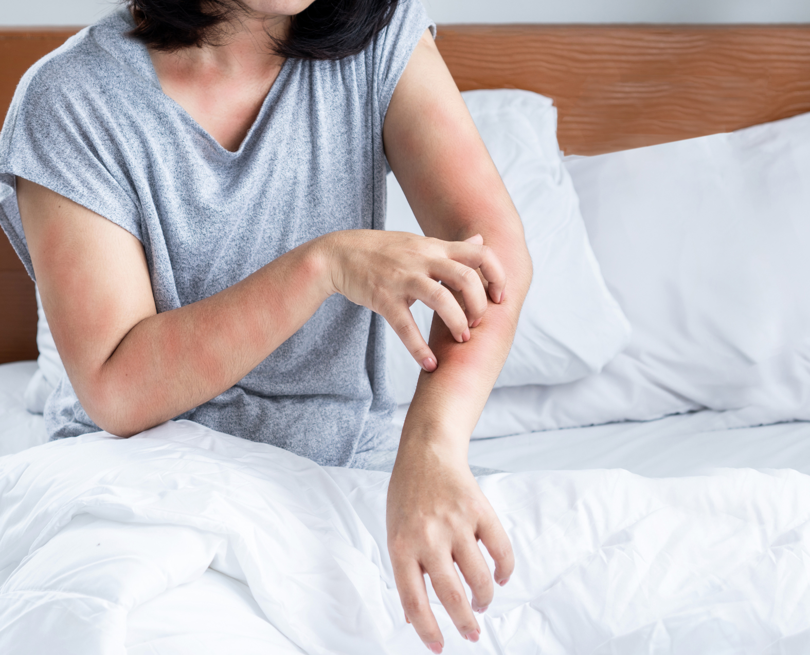 Fabric Rash Polyester Allergy: Causes, Symptoms, and Solutions – Kind Laundry